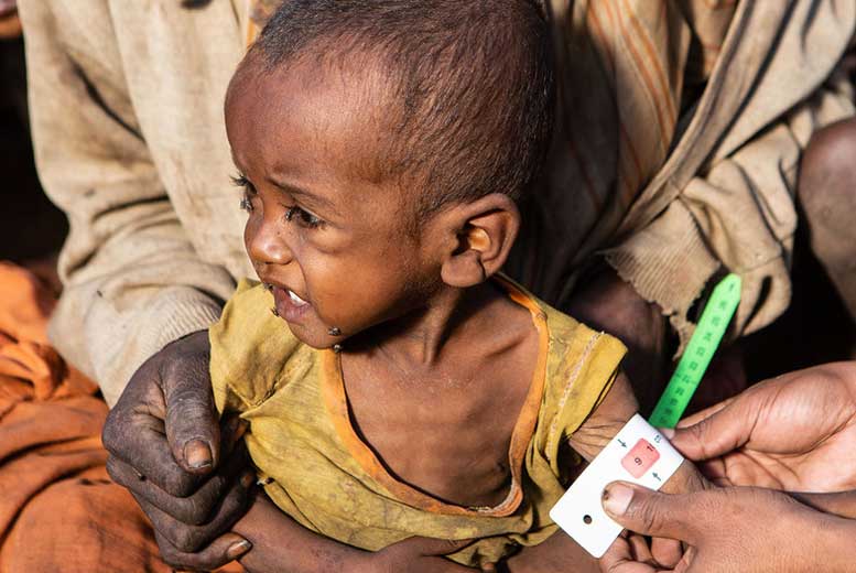 Мадагаскар: первый в мире голод из-за изменения климата