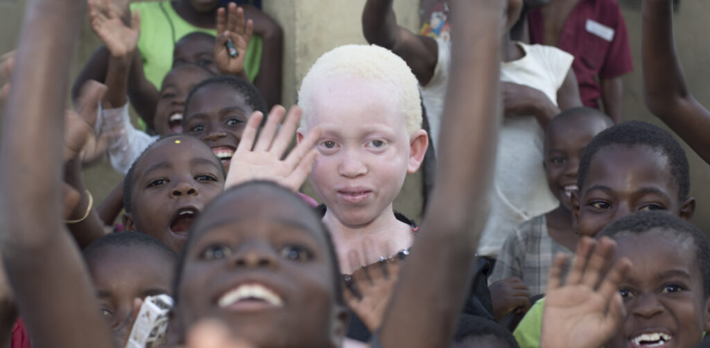 Нападения на альбиносов