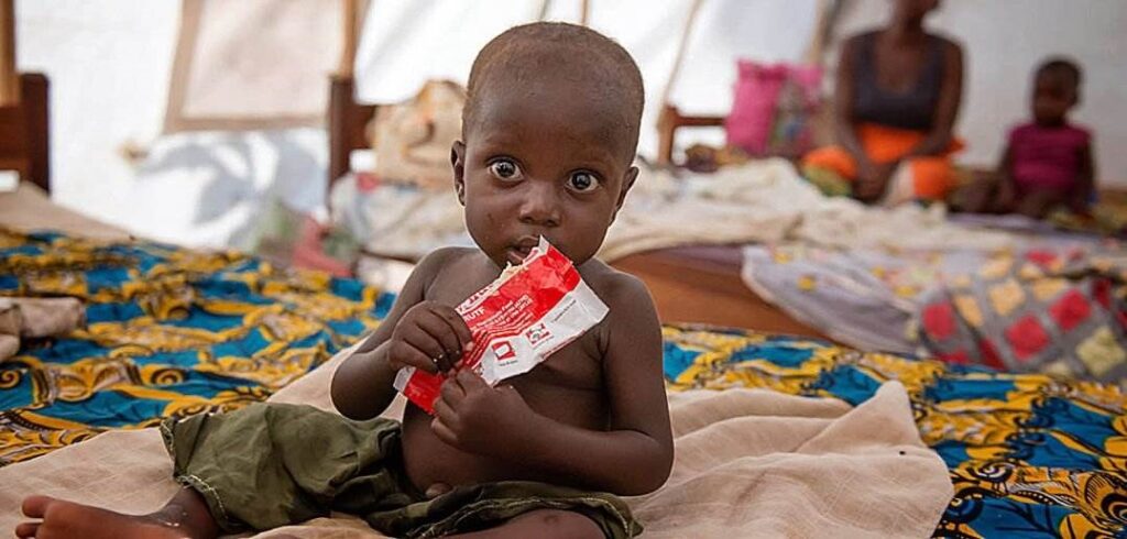 В мире 45 млн детей страдают от нехватки продуктов питания
