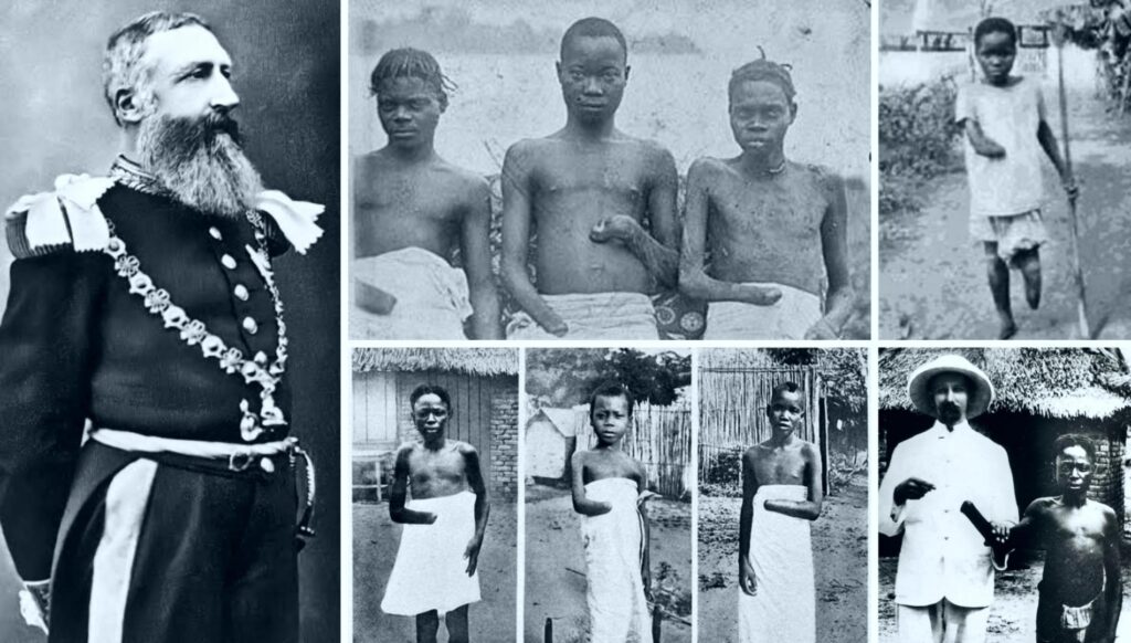 Леопольд II применял жестокие пытки, эксплуатация и геноцид в Конго