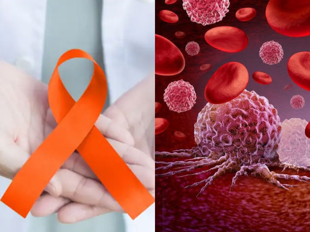 ТОП-30 стран по числу умерших от лейкемии в 2025 году