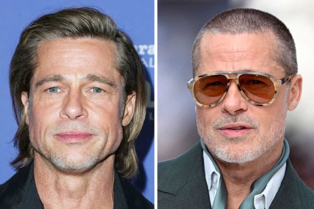 Брэд Питт — секс‑символ в 61: косметолог перечислил все операции и уколы красоты